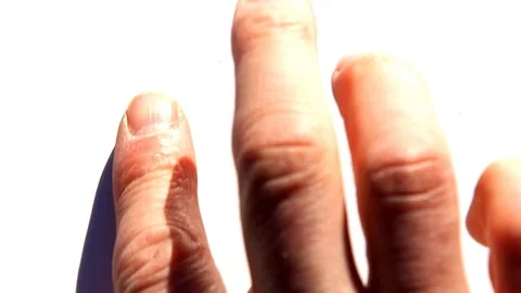 Mers Stock Footage 126357712