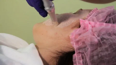 Meso glow bb procedure. Subcutaneous injection of serum for skin lightening. The Video stock 83620756
