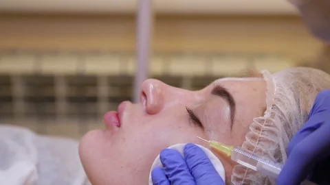 Mesotherapy injections in the face. Stock Footage 88078093