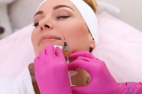 Mesotherapy injections in the face. Stock Photos