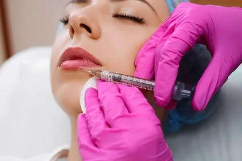 Mesotherapy injections in the face. Stock Photos