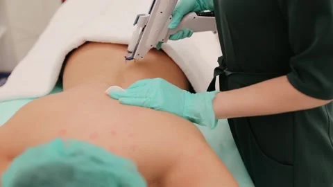 The mesotherapy procedure in process with injections into back of female client Stock Footage 134681899