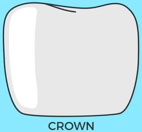 Metal-ceramic fixed prosthesis. Crown for simulating anatomical shape of teeth Stock Illustration