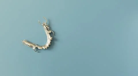 Metal Frame Lower Partial Denture, Cobalt Chrome Dental Plate, Bridge Printed By Stock Photos