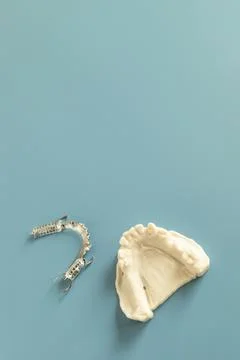 Metal Frame Lower Partial Denture with Die Stone, Plaster Cast Molds Of Lower Stock Photos