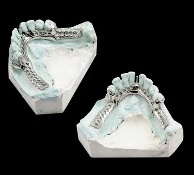 Metal frame work with clasps for partial denture on a black Stock Photos