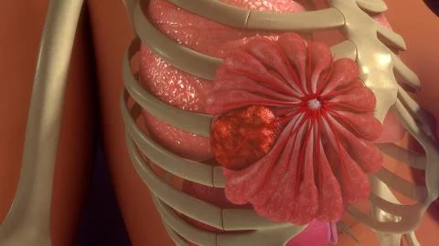 Metastasis Infection Illustrazione stock