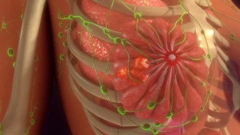 Metastasis Infection Illustrazione stock