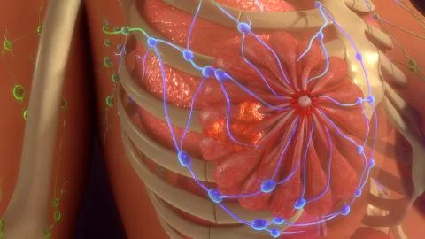 Metastasis Infection Illustrazione stock