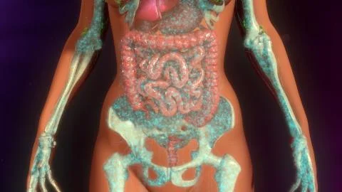 Metastasis Infection Illustrazione stock