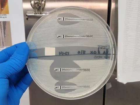 Methicillin sensitive and resistant staphylococcal isolates - E-test Stock Photos