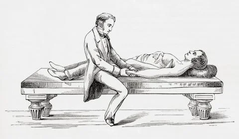 Method of reducing dislocation of the shoulder by the heel in the armpit. Fro Stock Photos