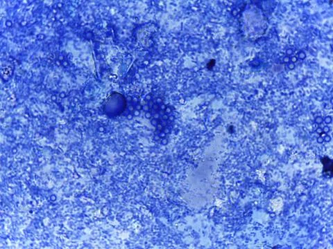 Methylene Blue Stained Micrograph of Mixed Bacterial Flora from a Human Fec.. 스톡 사진
