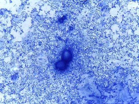 Methylene Blue Stained Micrograph of Mixed Bacterial Flora from a Human Fec.. 스톡 사진