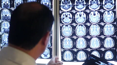 Mexico 2014: CLOSE UP-BACK SHOULDER. Doctor looking a brain scan. Stock Footage 48454116