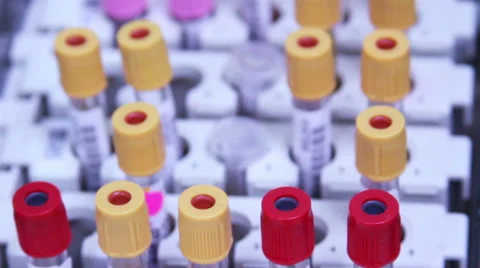 Mexico, 2014: CLOSE UP. Blood test tubes in a rack. Stock Footage 44987839