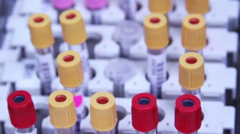 Mexico, 2014: CLOSE UP. Blood test tubes in a rack. Stock Footage 45037161