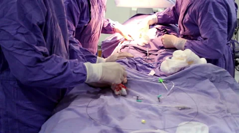 Mexico, 2014: CLOSE UP. Surgeons during operation. Stock Footage 45021537