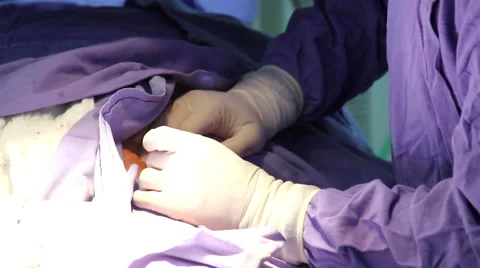 Mexico, 2014: CLOSE UP-TILT UP. Faces surgeons during surgery. Stock Footage 48475164