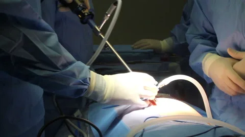 Mexico, 2014: MEDIUM SHOT-HANDHELD SHOT. Surgeons working in a OR. Stock Footage 42741663