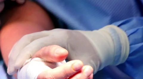 Mexico: CLOSE UP. Hands of surgeons working during a hand surgery. Stock Footage 48958416