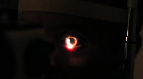 Mexico: CLOSE UP. Oculist doing an check up in the eyes of a patient. Stock Footage 48875787