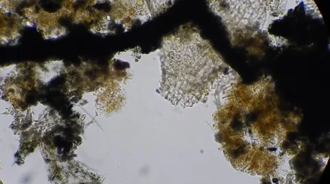 Micro garbage of plants under microscope, magn 200x 動画素材 54610493