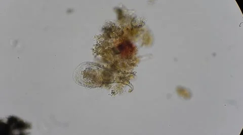 Micro garbage under microscope, magn 200x 動画素材 54610504