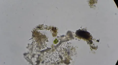 Micro garbage under microscope, magn 200x Stock-Footage 54612759