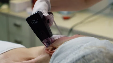 Micro-Needling Lift Procedure Experienced Cosmetologist for Youthful Appearance Stock Footage 267662254