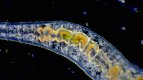 Micro organism - Flat worm crawling Stock Footage 189404520
