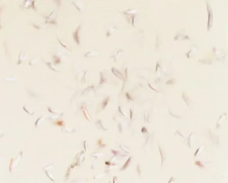 Micro Organism 库存影片 103864