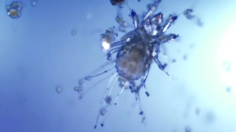 Micro organism insect mite, magnification 10x Stock Footage 222742615