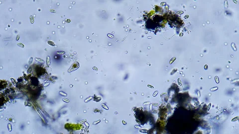 Micro organisms - Ciliates, microscope magnification Stock Footage 315756792
