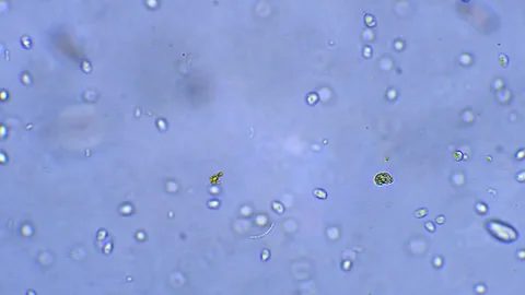 Micro organisms - Ciliates, microscope magnification Stock Footage 315757043