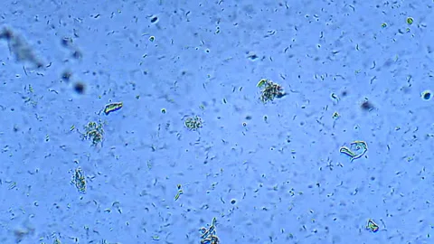 Micro organisms - Ciliates, microscope magnification Stock Footage 315757327