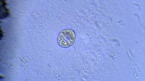 Micro organisms - Ciliates, microscope magnification Stock Footage 315757731