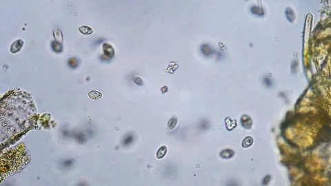 Micro organisms Ciliates moving in water Stock Footage 321404018