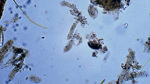Micro organisms Ciliates moving in water Stock Footage 321404289