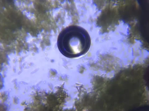 Micro Organisms Stock Footage 148512314