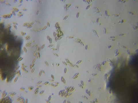 Micro Organisms Stock Footage 148671130