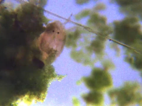 Micro Organisms Stock Footage 148671134