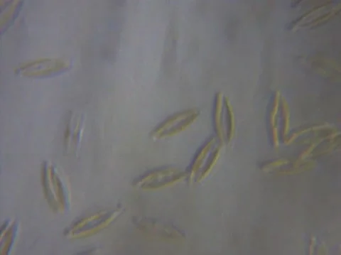 Micro Organisms Stock Footage 148671139