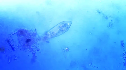 Micro organisms - Paramecium, microscope magnification Stock-Footage 315757212