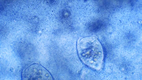 Micro organisms - Vorticella, microscope magnification Stock Footage 315757609