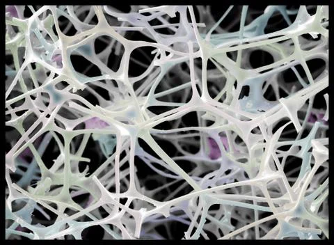 Micro-structure of "Magic Eraser" material, SEM Stock Photos