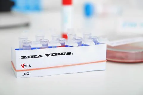 Micro tubes with  Blood sample positive with Zika virus Stock Photos