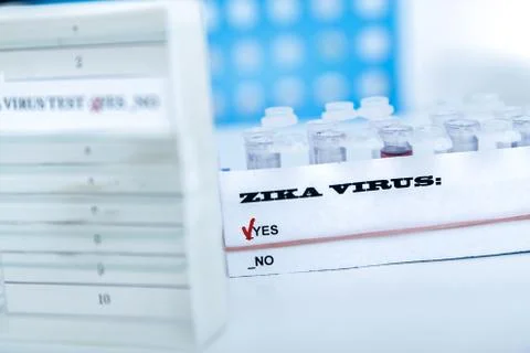 Micro tubes with  Blood sample positive with Zika virus Stock Photos