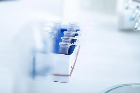 Micro tubes with  Blood sample positive with Zika virus Foto stock