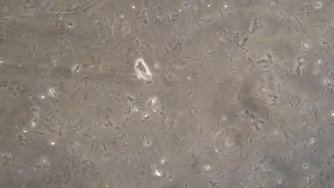 Micro video of spiral bacteria moving in a nutrient rich freshwater culture Vídeos de archivo 294600559